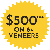 $500 off on 6+ veneers