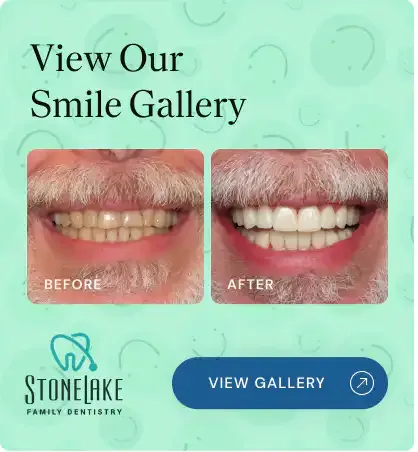 View our Smile Gallery: before and after photos of a smile makeover
